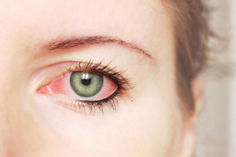 Glaucoma: &iquest;qu&eacute; lo causa?